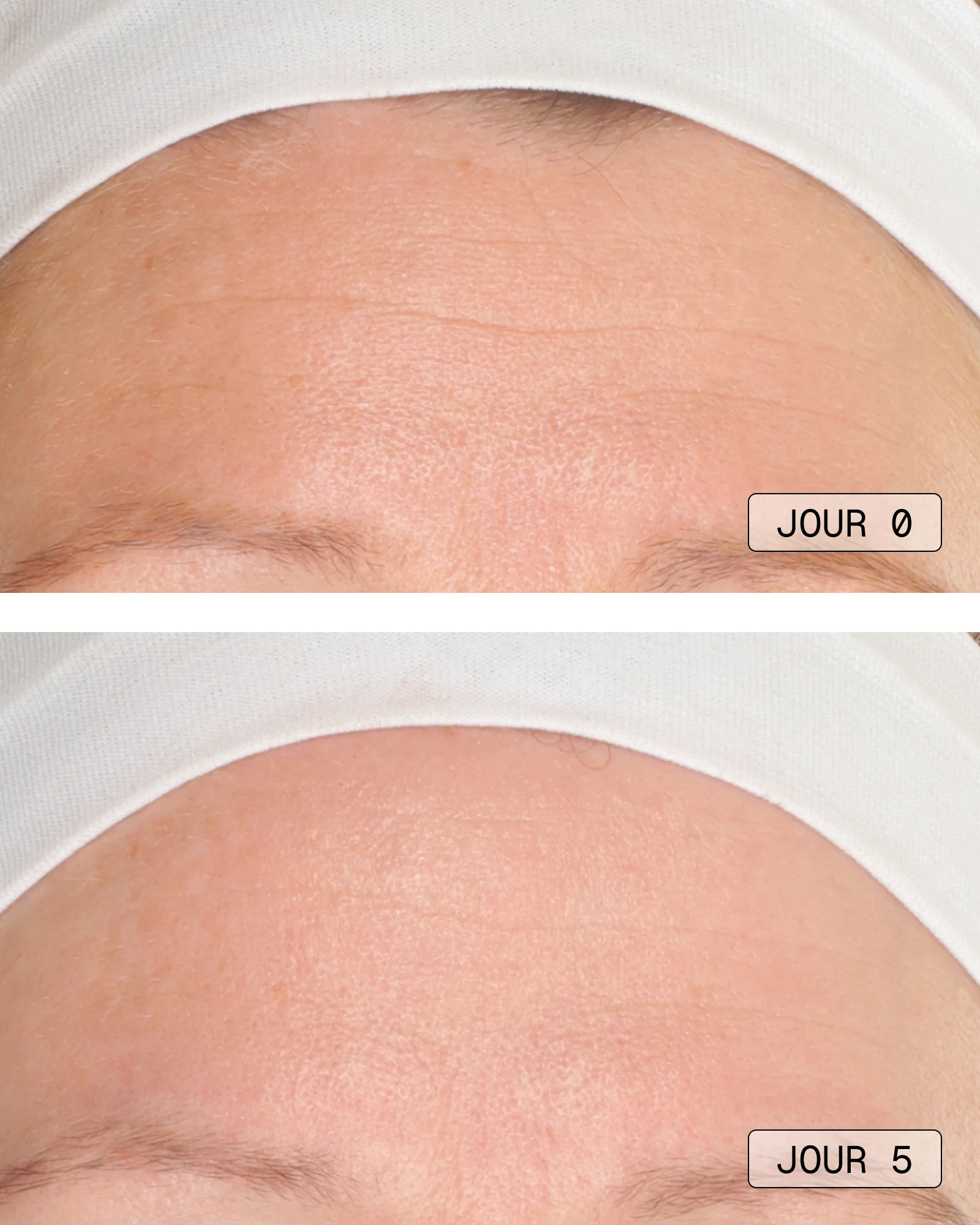 Boost Argireline® | Anti-Wrinkle Perfecting Serum - Image 8