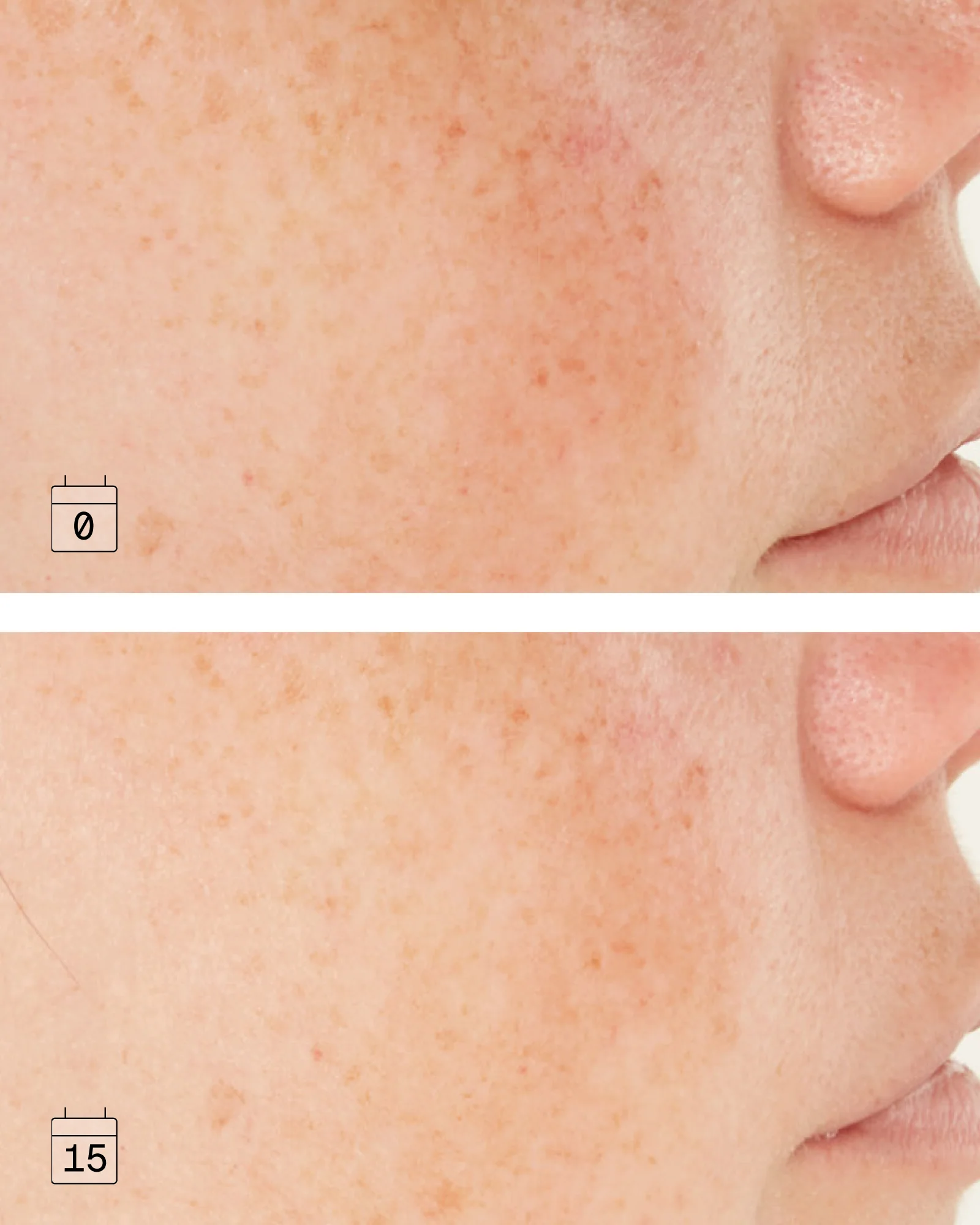 Boost Niacinamide B3 | Anti-Dark Spot Correcting Serum - Image 4