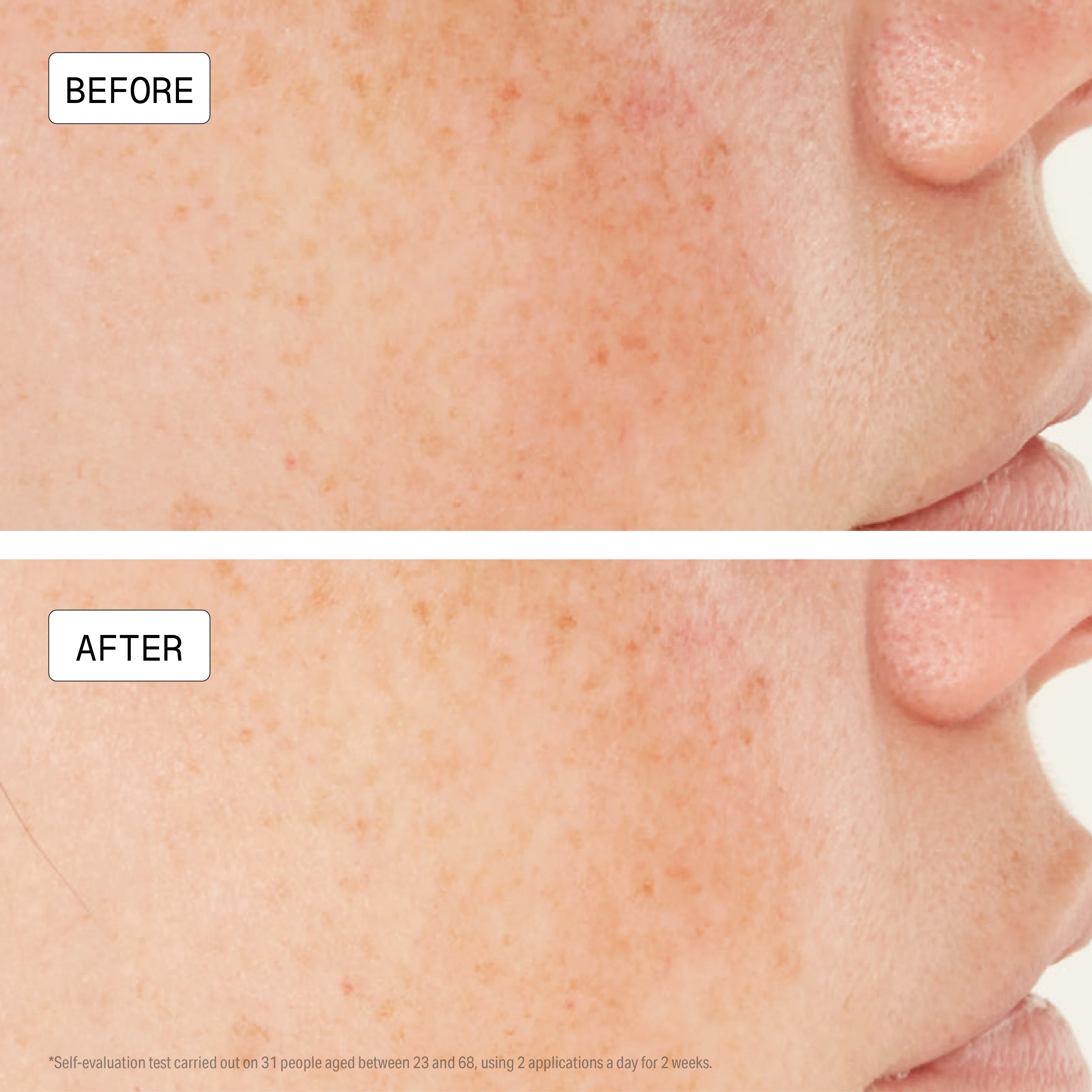 Dark Spot & UV Defense Duo - Image 4