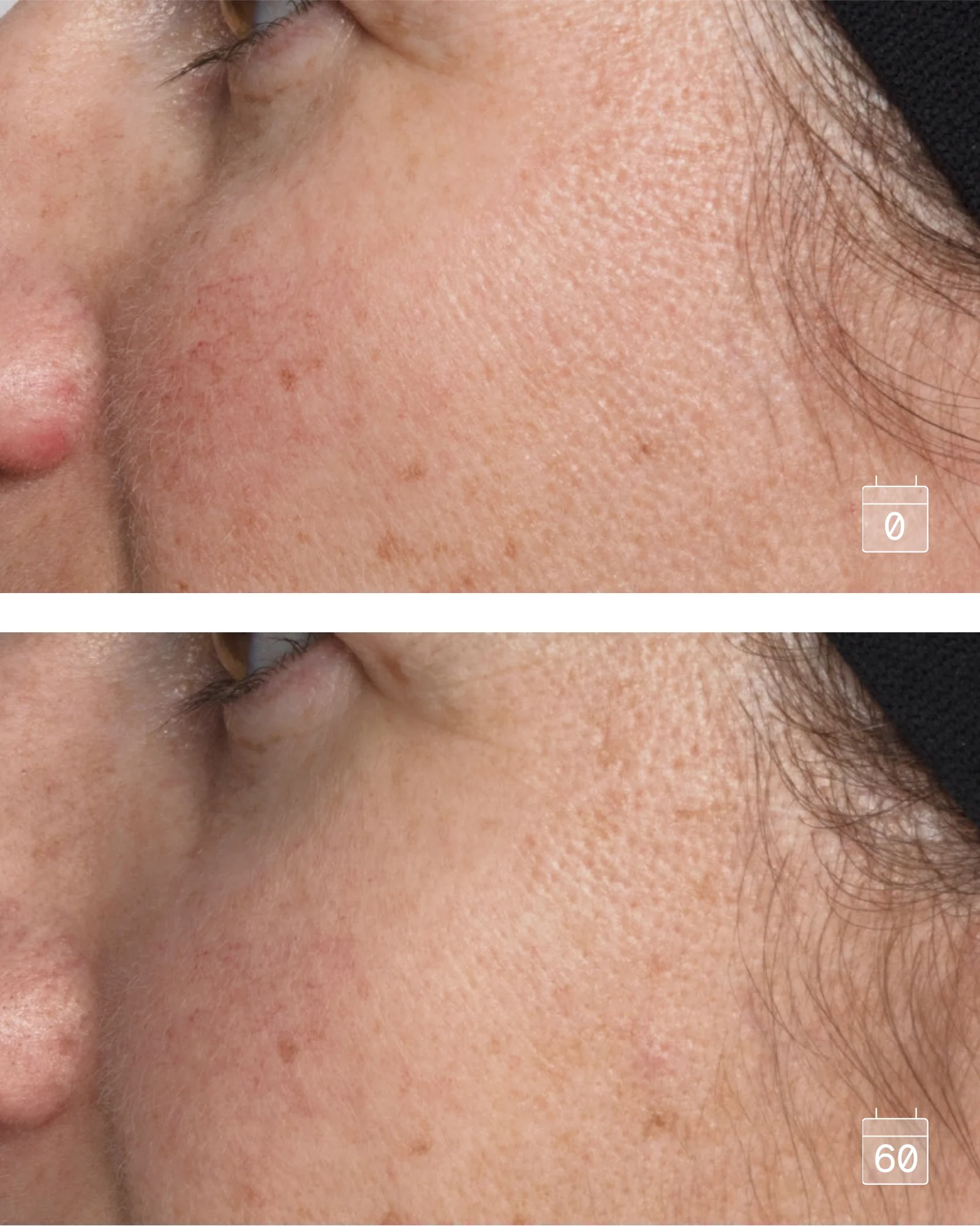 Express Mat | All-in-one Anti-aging Mattifying Cream-Serum - Image 3